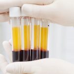 Aprueba El Vaticano el uso de vacunas contra el Coronavirus aún de origen abortivo, a falta de otras
