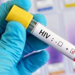 La vacuna contra el VIH ya es probada en Yucatán