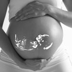La Arquidiócesis de México aseguró que la lucha por los derechos humanos pasa por la derrota del aborto