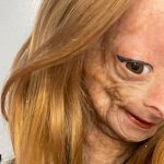 Muere, a los 15 años de edad, Adalia Rose Williams, youtuber que vivía con progeria